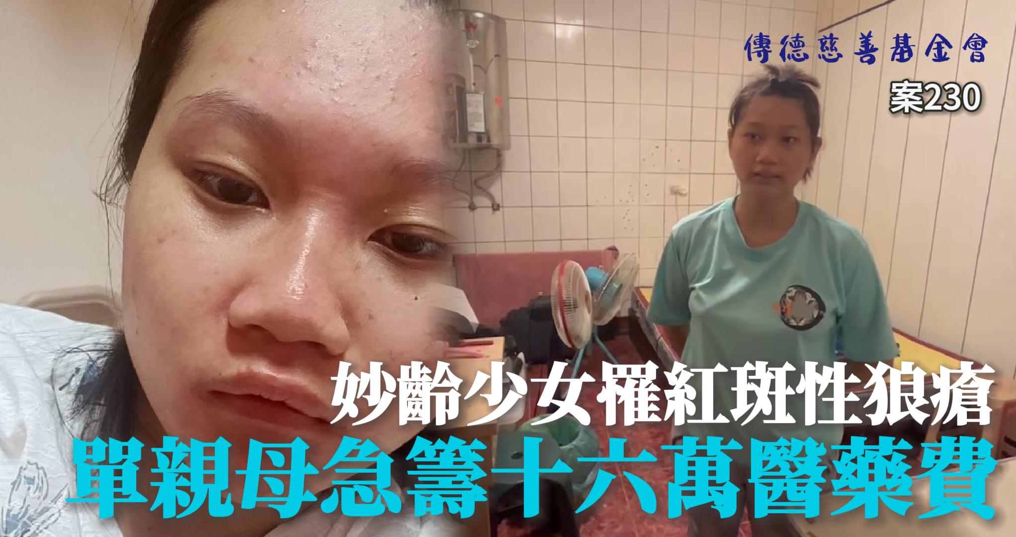 【230已結案】少女罹紅斑性狼瘡，單親母為籌一年四次高昂的針劑費用心力交瘁(標題圖檔)