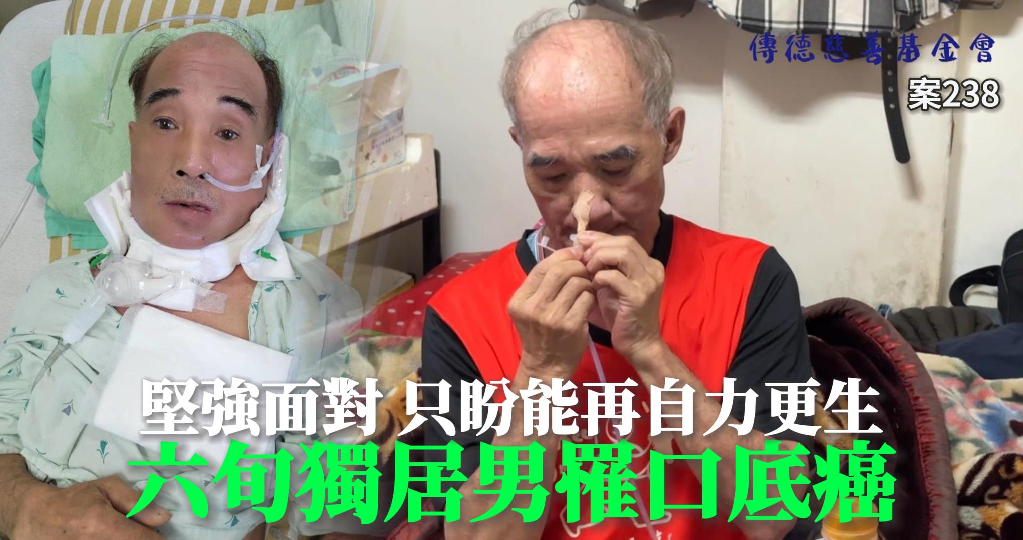 六旬獨居男罹口底癌，堅強面對只盼能再自力更生(標題圖檔)
