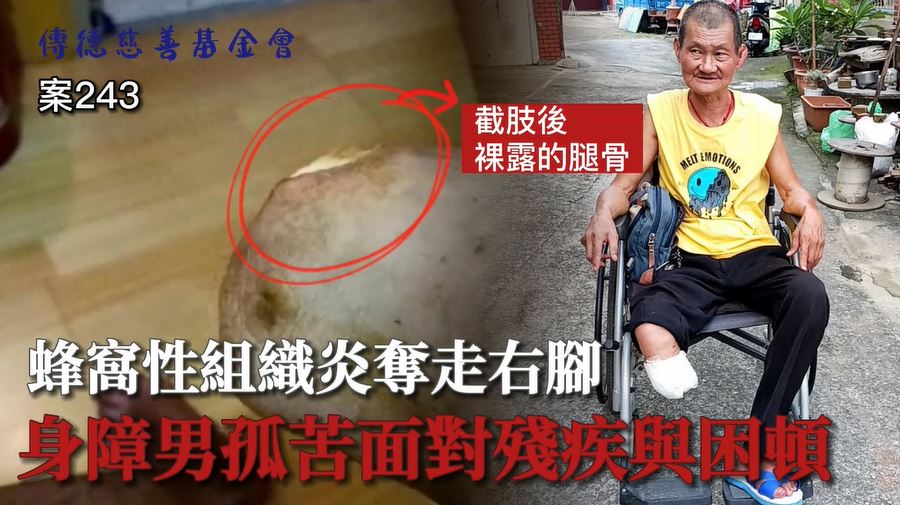 【243已結案】蜂窩性組織炎奪走右腳，身障男孤苦面對殘疾與拮据生活(標題圖檔)