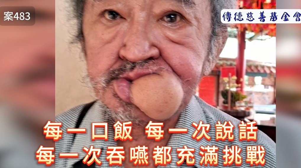 每一口飯、每一次說話、每一次吞嚥都充滿挑戰(標題圖檔)